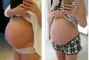 На 33 неделе беременности опустился живот