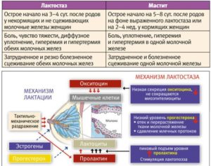 Что делать при мастите у кормящих мам