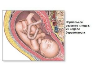 Изжога на 26 неделе беременности
