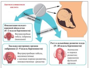 Что можно выпить от головы при беременности в 1 триместре