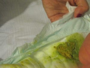 Зеленый кал у младенца на искусственном вскармливании