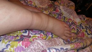 38 неделя беременности болит между ног