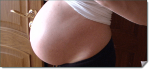 Чешется живот на 38 неделе беременности
