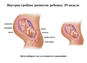 39 неделя беременности колит внизу живота