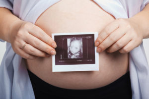 Во сколько недель делают первое узи при беременности