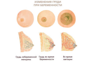 На 9 неделе беременности грудь болит меньше