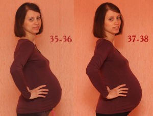 37 недель беременности ноет поясница