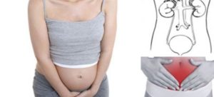 Цистит на 15 неделе беременности