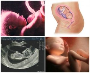 Как ребенок выглядит в 26 недель беременности