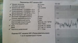 Ктг на 38 неделе беременности норма показателей