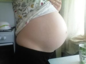 Многоводие на 20 неделе беременности