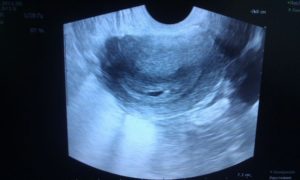 Беременность 2 недели от зачатия