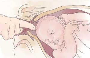 38 недель беременности как вызвать роды