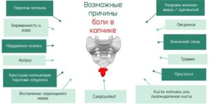 Болит копчик на 16 неделе беременности