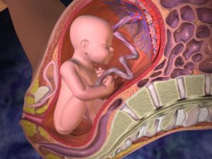 Отслойка плаценты на 19 неделе беременности