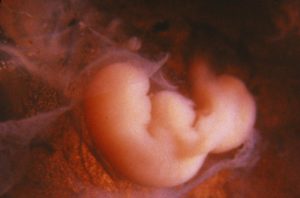 Эмбрион на 2 неделе беременности