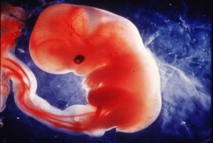 5 неделя беременности эмбриональная