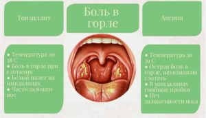 На 38 неделе беременности горло болит