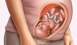 На 31 неделе беременности тонус матки