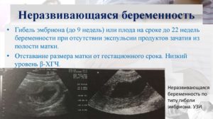 Как проявляется замершая беременность в первом триместре