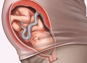 На 36 неделе беременности болит желудок