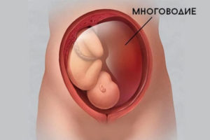 Тонус матки на 18 неделе беременности