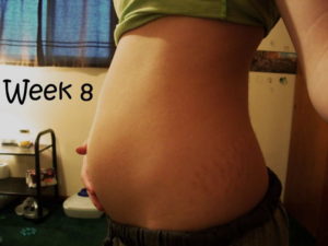 8 недель беременности двойней