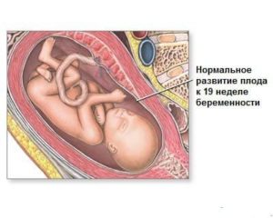 Выделения на 19 неделе беременности