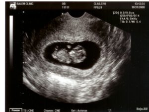 Беременность 10 недель развитие