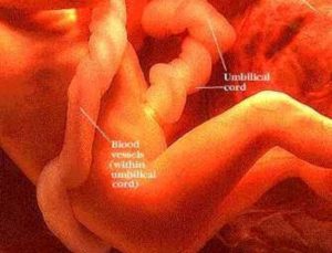 Молозиво на 28 неделе беременности