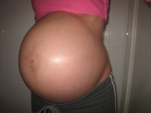 На 36 неделе беременности болит желудок