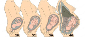 Тошнота на 40 неделе беременности что это