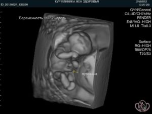 Плод 12 недель беременности размер плода