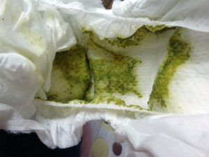 Зеленый кал у грудничка на искусственном вскармливании