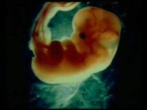 6 недель беременности что происходит с малышом