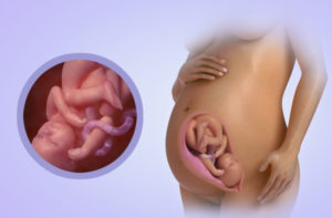 Обвитие пуповиной на 32 неделе беременности вокруг шеи