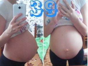 Каменеет живот на 29 неделе беременности