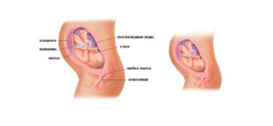 Положение плода на 29 неделе беременности