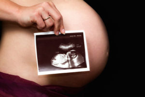Узи в первом триместре беременности