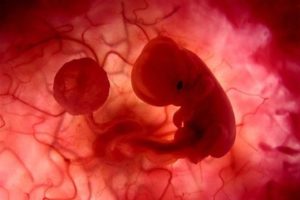 Аборт беременности 2 недели