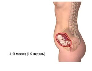 На 16 неделе беременности болит низ живота