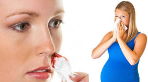 Кровь из носа при беременности второй триместр причины