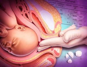 39 недель беременности покалывание во влагалище