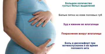 Молочница на 26 неделе беременности