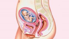 Тонус матки на 27 неделе беременности