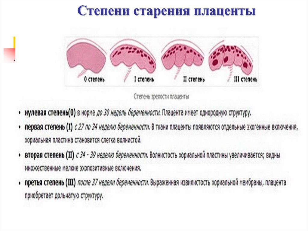 Преждевременное старение плаценты на 31 неделе беременности