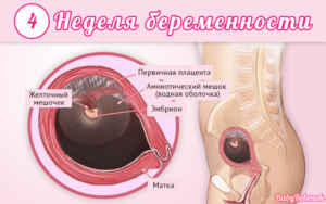 Беременность 4 недели симптомы