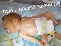 Отошли воды на 27 неделе беременности