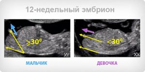 Можно ли на 12 неделе беременности узнать пол ребенка