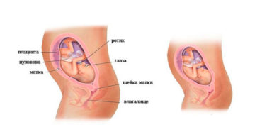 26 неделя беременности расположение плода